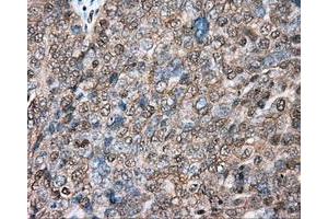 Immunohistochemical staining of paraffin-embedded colon tissue using anti-BSG mouse monoclonal antibody. (CD147 anticorps)