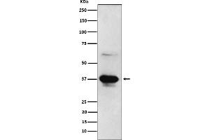 Western blot analysis of ICAD expression in HeLa cell lysate.