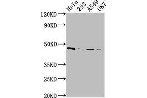 Western Blot Positive WB detected in: Hela whole cell lysate, 293 whole cell lysate, A549 whole cell lysate, U87 whole cell lysate All lanes: MAP2K1 antibody at 1:2000 Secondary Goat polyclonal to rabbit IgG at 1/50000 dilution Predicted band size: 44, 41 kDa Observed band size: 44 kDa (Recombinant MEK1 anticorps)