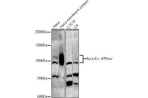 Western blot analysis of extracts of various cell lines, using Na+/K+-ATPase antibody (ABIN6133568, ABIN6137299, ABIN6137301 and ABIN6223860) at 1:500 dilution. (ATP1A1 anticorps  (AA 1-100))