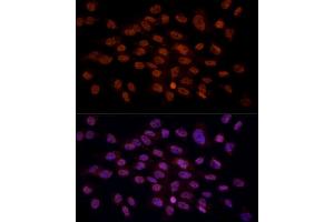 Immunofluorescence analysis of C6 cells using CRYGC antibody (ABIN6130868, ABIN6139079, ABIN6139080 and ABIN6224977) at dilution of 1:100 (40x lens).