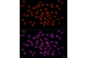 Immunofluorescence analysis of C6 cells using CRYGC antibody (ABIN6130868, ABIN6139079, ABIN6139080 and ABIN6224977) at dilution of 1:100 (40x lens). (CRYGC anticorps  (AA 1-174))