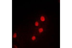 Immunofluorescent analysis of PDCD5 staining in MCF7 cells. (PDCD5 anticorps)