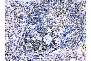 Anti- Ikaros Picoband antibody, IHC(P) IHC(P): Rat Spleen Tissue (IKZF1 anticorps  (C-Term))