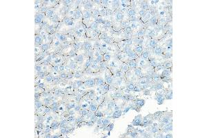 Immunohistochemistry of paraffin-embedded rat liver using LNPEP Rabbit pAb (ABIN6129286, ABIN6143284, ABIN6143285 and ABIN6215523) at dilution of 1:100 (40x lens).