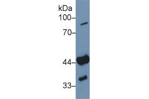 Detection of ADA in Human Jurkat cell lysate using Polyclonal Antibody to Adenosine Deaminase (ADA) (ADA anticorps  (AA 11-280))