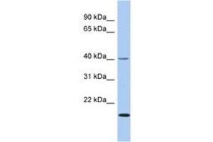 Image no. 1 for anti-Zinc Finger Protein 396 (ZNF396) (AA 215-264) antibody (ABIN6742523) (ZNF396 anticorps  (AA 215-264))