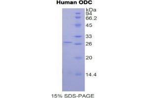 SDS-PAGE analysis of Human ODC Protein.