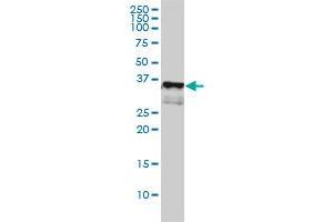CD1A monoclonal antibody (M01), clone M1-2-1B5 Western Blot analysis of CD1A expression in K-562 . (CD1a anticorps  (AA 1-311))