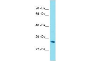 Western Blotting (WB) image for anti-Glutathione S-Transferase theta 2 (GSTT2) (Middle Region) antibody (ABIN2789659) (GSTT2 anticorps  (Middle Region))