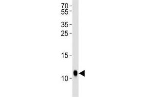 Western blot analysis of lysate from Drosophila tissue lysate using SUMO antibody diluted at 1:1000. (SUMO anticorps  (AA 37-66))