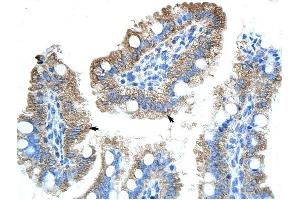 GTPBP9 antibody was used for immunohistochemistry at a concentration of 4-8 ug/ml to stain Epithelial cells of intestinal villus (arrows) in Human Intestine. (OLA1 anticorps)