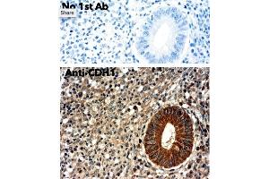 Immunohistochemistry (IHC) image for anti-Cadherin 1, Type 1, E-Cadherin (Epithelial) (CDH1) antibody (ABIN1440031)