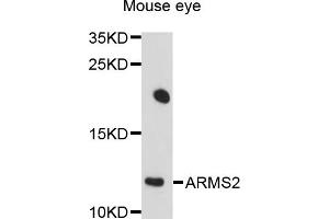 Western blot analysis of extracts of mouse eye, using ARMS2 antibody (ABIN4902948) at 1:1000 dilution. (ARMS2 anticorps)
