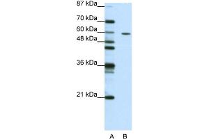 WB Suggested Anti-ZNF382 Antibody Titration:  1. (ZNF382 anticorps  (N-Term))