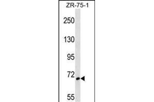SH3BP1 Antibody (Center) (ABIN1538408 and ABIN2848605) western blot analysis in ZR-75-1 cell line lysates (35 μg/lane). (SH3BP1 anticorps  (AA 419-446))