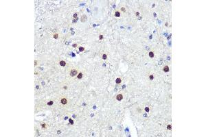 Immunohistochemistry of paraffin-embedded mouse spinal cord using HES1 Rabbit mAb (ABIN7267624) at dilution of 1:100 (40x lens).