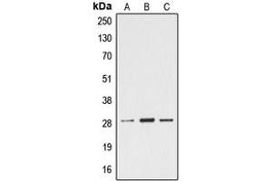 Western blot analysis of Ephrin A4 expression in Jurkat (A), mouse heart (B), rat heart (C) whole cell lysates. (EFNA4 anticorps  (C-Term))