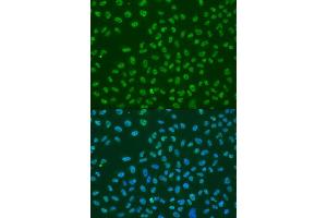 Immunofluorescence analysis of U2OS cells using ELAVL1 antibody (ABIN6292898) at dilution of 1:100. (ELAVL1 anticorps)