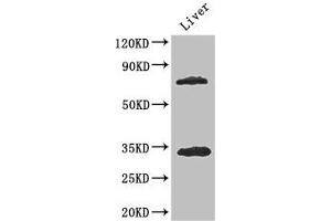 Western Blot Positive WB detected in: Mouse liver tissue All lanes: HDAC10 antibody at 3. (HDAC1 anticorps  (AA 207-412))
