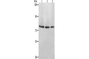 Gel: 8 % SDS-PAGE, Lysate: 40 μg, Lane 1-3: Mouse stomach tissue, Mouse liver tissue, Mouse kidney tissue, Primary antibody: ABIN7128170(ACOX1 Antibody) at dilution 1/350, Secondary antibody: Goat anti rabbit IgG at 1/8000 dilution, Exposure time: 1 minute (ACOX1 anticorps)