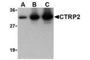 Western blot of recombinant CTRP2: (A) 5 ng, (B) 25 ng, and (C) 50 ng with AP30250PU-N CTRP2 at 1 ug/ml.