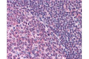 Anti-FPR1 antibody IHC of human tonsil. (FPR1 anticorps  (Extracellular Domain))