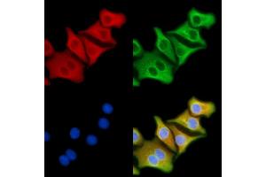 ABIN6257114 and ABIN6274151 staining Hela cells by IF/ICC. (CKM anticorps  (N-Term))