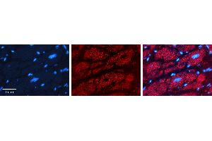 Rabbit Anti-PHB2 Antibody   Formalin Fixed Paraffin Embedded Tissue: Human heart Tissue Observed Staining: Cytoplasmic Primary Antibody Concentration: 1:100 Other Working Concentrations: 1:600 Secondary Antibody: Donkey anti-Rabbit-Cy3 Secondary Antibody Concentration: 1:200 Magnification: 20X Exposure Time: 0.