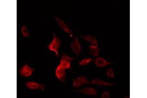 ABIN6274969 staining RAW264. (CPE anticorps  (Internal Region))