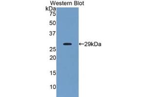 Western blot analysis of recombinant Human ANGPTL2. (ANGPTL2 anticorps  (AA 267-493))