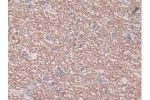 Detection of PAI1 in Human Cerebrum Tissue using Monoclonal Antibody to Plasminogen Activator Inhibitor 1 (PAI1)