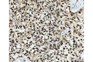 IHC analysis of UBC12/UBE2M using anti-UBC12/UBE2M antibody (ABIN7600885). (UBE2M anticorps  (AA 25-154))