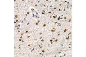 Immunohistochemistry of paraffin-embedded rat brain using ID3 antibody (ABIN6130481, ABIN6142140, ABIN6142141 and ABIN6221020) at dilution of 1:200 (40x lens). (ID3 anticorps  (AA 1-119))