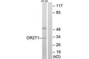 Western Blotting (WB) image for anti-Similar To Olfactory Receptor, Family 2, Subfamily T, Member 1 (OR2T1) (AA 231-280) antibody (ABIN2890990) (OR2T1 anticorps  (AA 231-280))