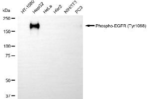 Western blotting analysis using phospho-EGFR (Tyr) antibody (ABIN7798464).
