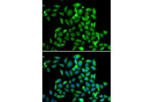 Immunofluorescence analysis of A549 cells using CLASP1 antibody. (CLASP1 anticorps)