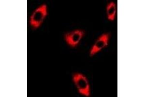 Immunofluorescent analysis of GTL3 staining in A549 cells. (C16orf80 anticorps)