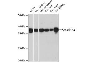 Western blot analysis of extracts of various cell lines, using Annexin  Rabbit mAb (ABIN7265619) at 1:1000 dilution. (Annexin A2 anticorps)
