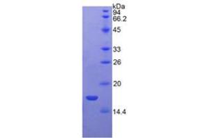 SDS-PAGE analysis of Rat VEGFB Protein.