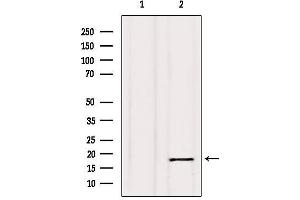 Western blot analysis of extracts from Hela, using Calmodulin Antibody.