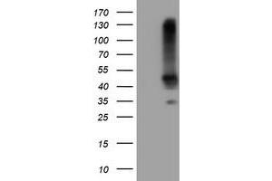 Image no. 2 for anti-serpin Peptidase Inhibitor, Clade B (Ovalbumin), Member 1 (SERPINB1) (AA 77-306) antibody (ABIN1491673) (SERPINB1 anticorps  (AA 77-306))
