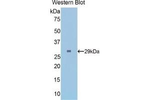 Detection of Recombinant FGg, Mouse using Polyclonal Antibody to Fibrinogen Gamma (FGg)