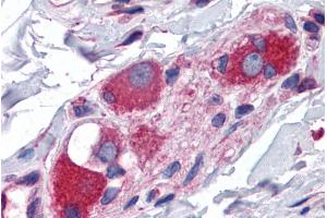 ABIN184829 (3. (ARL6IP5 anticorps  (C-Term))