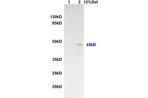 Lane 1: rat brain lysates Lane 2: rat heart lysates probed with Anti phospho-GFAP (Ser8) Polyclonal Antibody, Unconjugated (ABIN800838) at 1:200 in 4 °C. (GFAP anticorps  (pSer8))