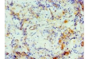 Immunohistochemistry of paraffin-embedded human testis tissue using ABIN7149061 at dilution of 1:100 (CRISP2 anticorps  (AA 22-243))