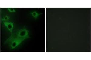 Immunofluorescence analysis of HeLa cells, using CIDEC Antibody.