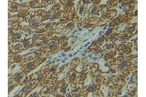 DAB staining on IHC-P; Samples: Human Liver Tissue