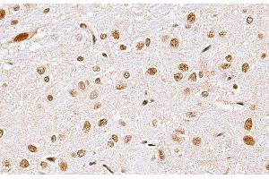 Immunohistochemistry of paraffin-embedded Rat brain using CBX6 Polyclonal Antibody at dilution of 1:100 (40x lens). (CBX6 anticorps)