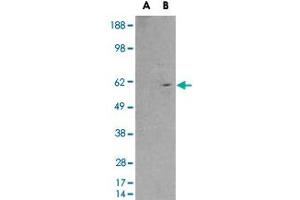 HEK293 overexpressing RXRB and probed with RXRB polyclonal antibody  (mock transfection in first lane), tested by Origene. (Retinoid X Receptor beta anticorps)